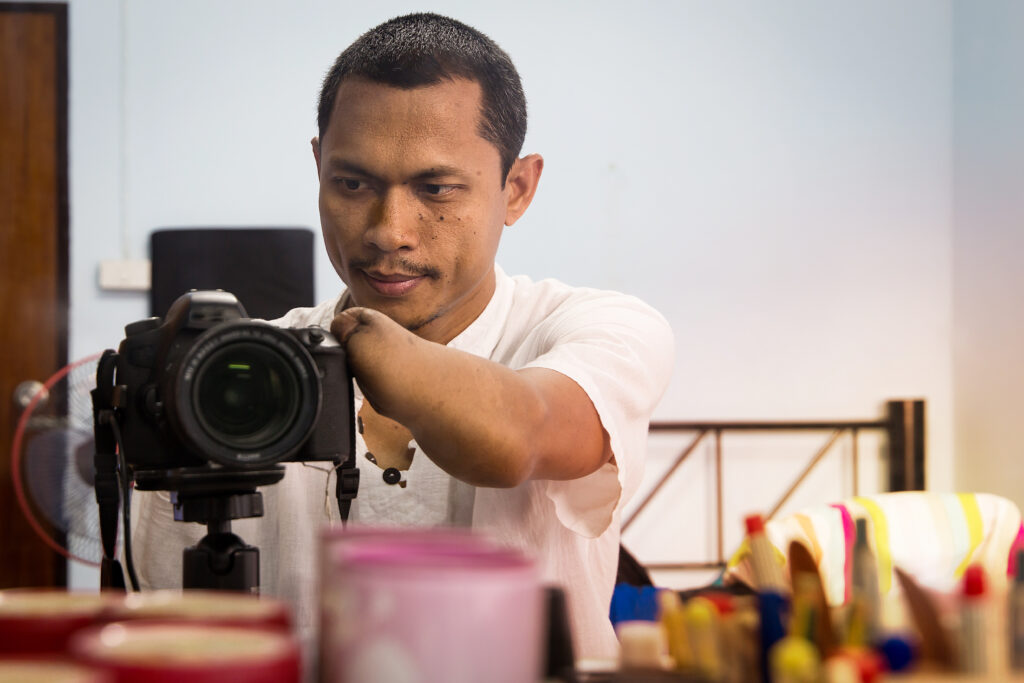 A man taking a picture with a camera. The man has had his left hand amputated at the wrist and is using that arm to hold the camera.